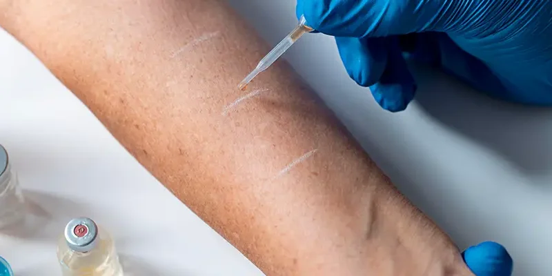 Kılcal Damar Tedavisi