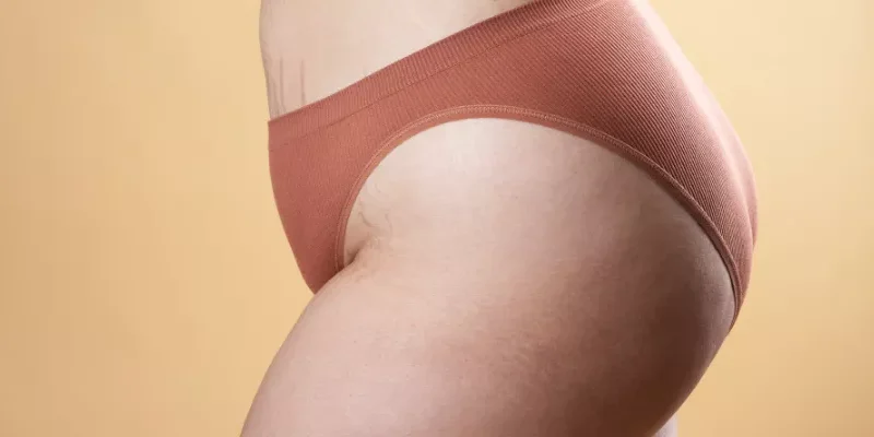 Radyofrekans ile Cilt Sıkılaştırma